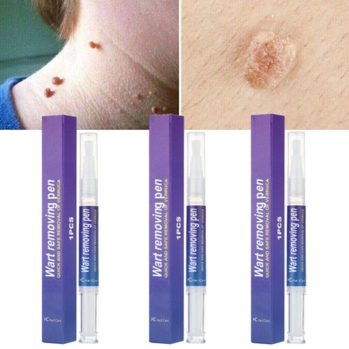 Pack hours wart - pack,