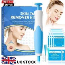 Natural Painless Auto SKIN TAG