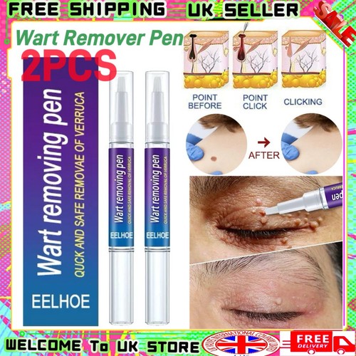 2pack hours wart - 12,