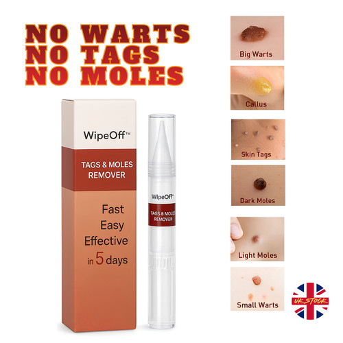 Wart remover fast - remover, &