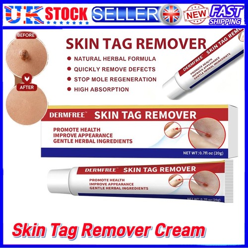 Strong skin tag - tag, remover