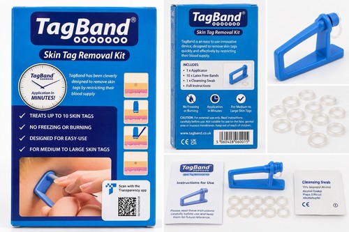 Tagband skin tag removal - tagband,