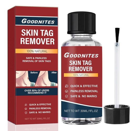 Skin tag remover 15ml - skin,