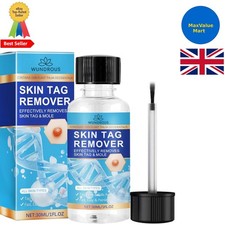 Skin Tag Remover - Fast