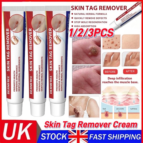 Strong skin tag remover cream - strong,